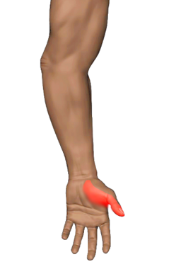Pain region 3